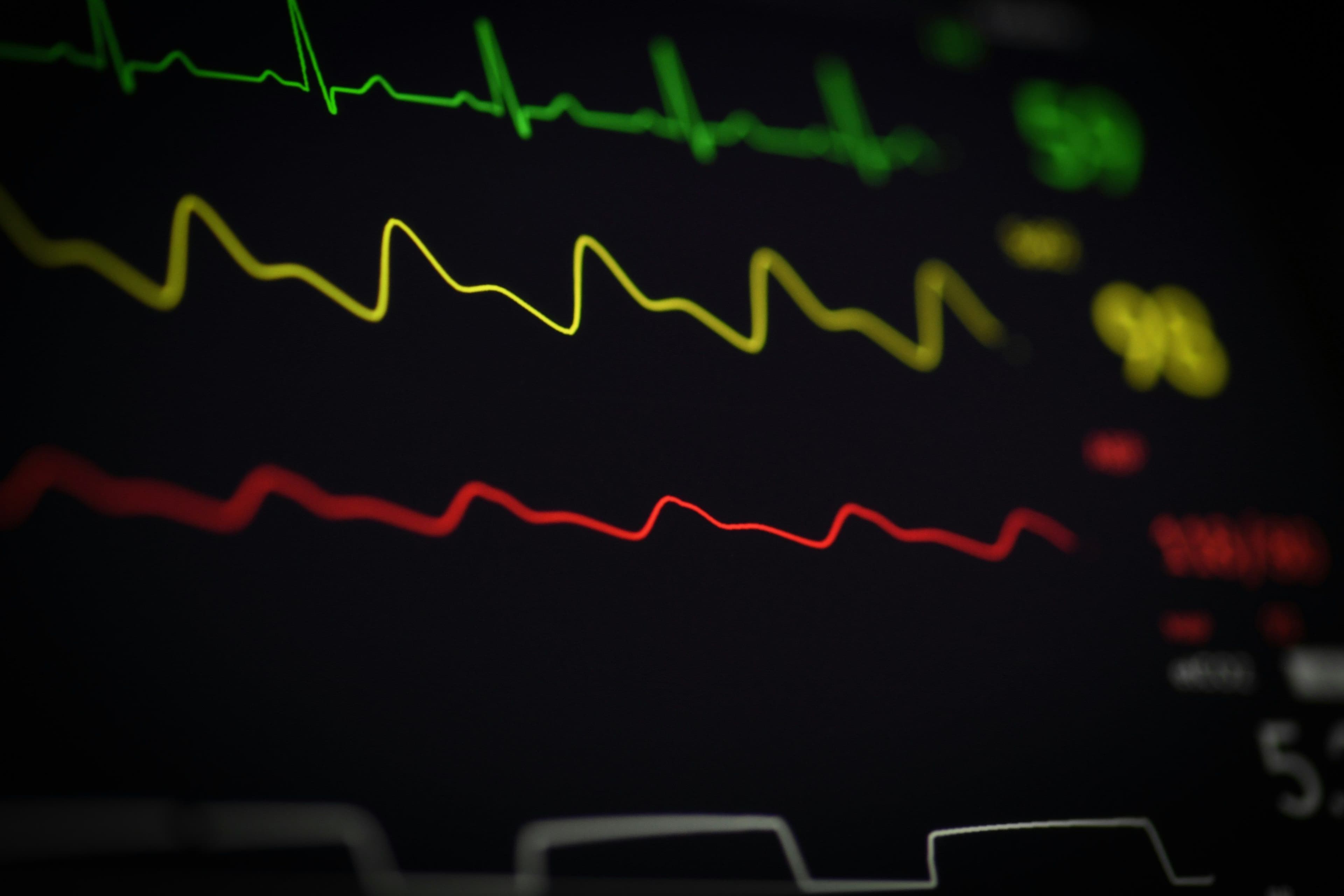 EKG-Kurve als Nahaufnahme auf schwarzem Monitor; abstrahierte Herzschlaglinie.
